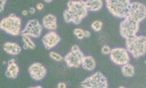Y1(Y-1)小鼠腎上腺皮質(zhì)瘤細(xì)胞質(zhì)粒載體網(wǎng)細(xì)胞庫(kù)