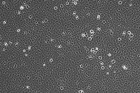 細(xì)胞購(gòu)買NCI-N87 [N87]人胃癌細(xì)胞zlzt生物